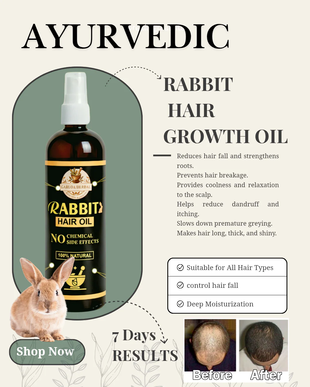 Garuda Rabbit Herbal Hair Oil(5.0 ⭐⭐⭐⭐⭐ 18,345 REVIEWS) Globally